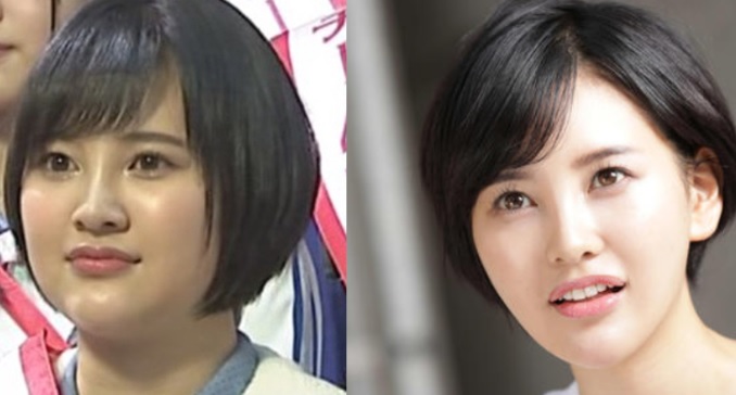 阿部 マリア 整形