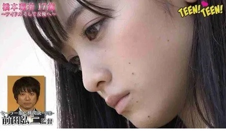 橋本環奈は鼻を整形していることが確定 あの不自然な跡はプロテーゼだった 真相まとめ Secret Note 橋本環奈は鼻を整形していることが確定 あの不自然な跡はプロテーゼだった 真相まとめ Secret Note