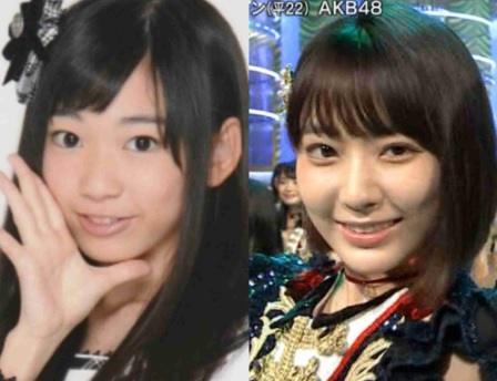 宮脇咲良は整形して田舎娘から韓国美女に大変身 いじった箇所や施術内容などを徹底調査 Secret Note